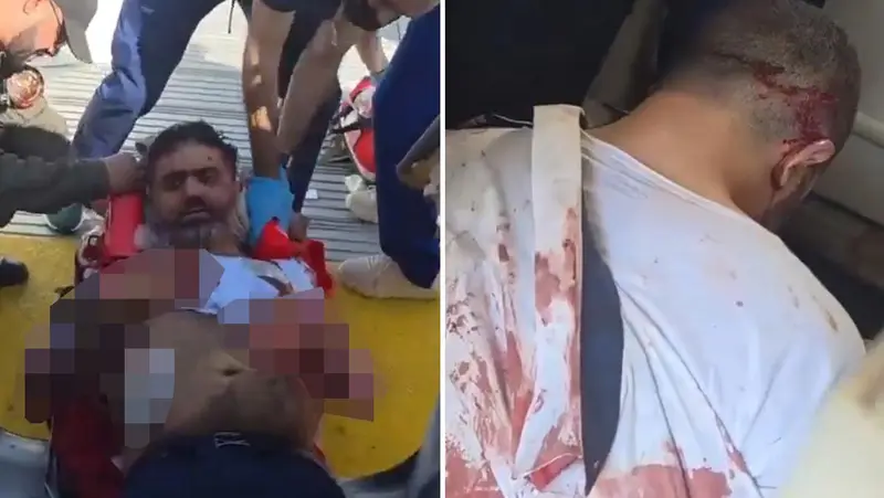 🚁✈️ ¡Impactante! Primeras imágenes del rescate del piloto herido en vuelo de Flydubai en Maracaibo