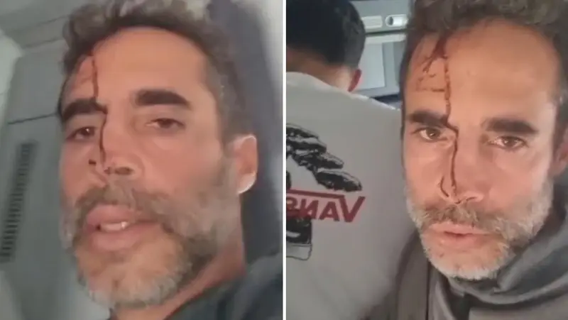 🚨💥 ¡IMPACTANTE! Video desde la cabina: Pasajero ensangrentado pide auxilio en emergencia del vuelo Flydubai 🛬😨