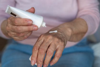 De rutina a tragedia: un anciano muere tras incendiarse su crema humectante