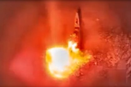 VIDEO: Israel ataca por primera vez barcos de la Marina iraní en el mar Caspio