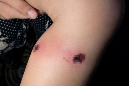 Informan que el Ejército israelí torturó a un niño palestino de 18 meses y las FDI responden