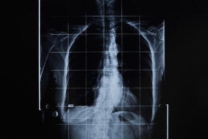 "Sacos de órganos": una startup apoyada por un multimillonario quiere crear cuerpos humanos sin cerebro