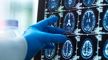 Los consejos de la ciencia para tener un cerebro hasta 8 años más joven