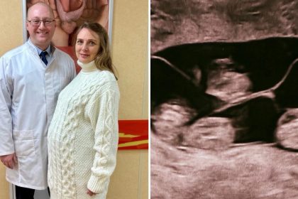 Un caso único en millones: Rusia celebra el nacimiento de sus primeras cuatrillizas idénticas