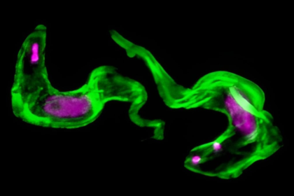 Resuelven un misterio de 40 años sobre rara enfermedad del sueño