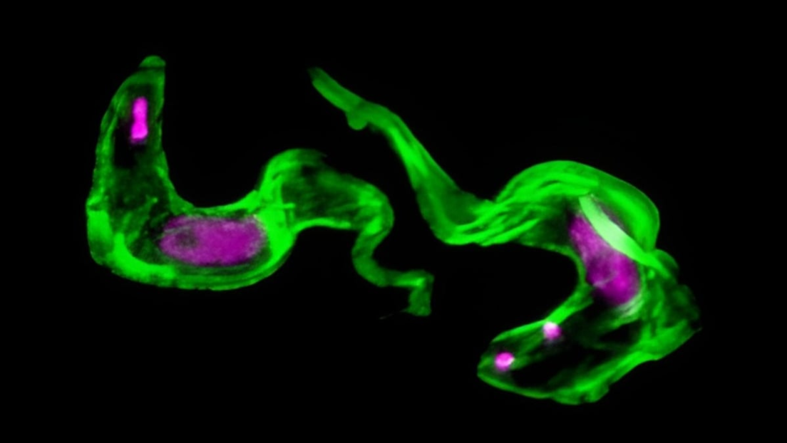Resuelven un misterio de 40 años sobre rara enfermedad del sueño