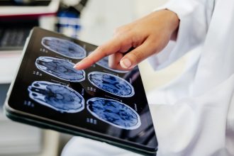 Descubren cómo detectar alzhéimer mucho antes de que aparezcan síntomas