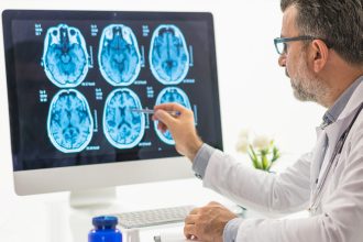 Identifican un factor que reduce el riesgo de demencia
