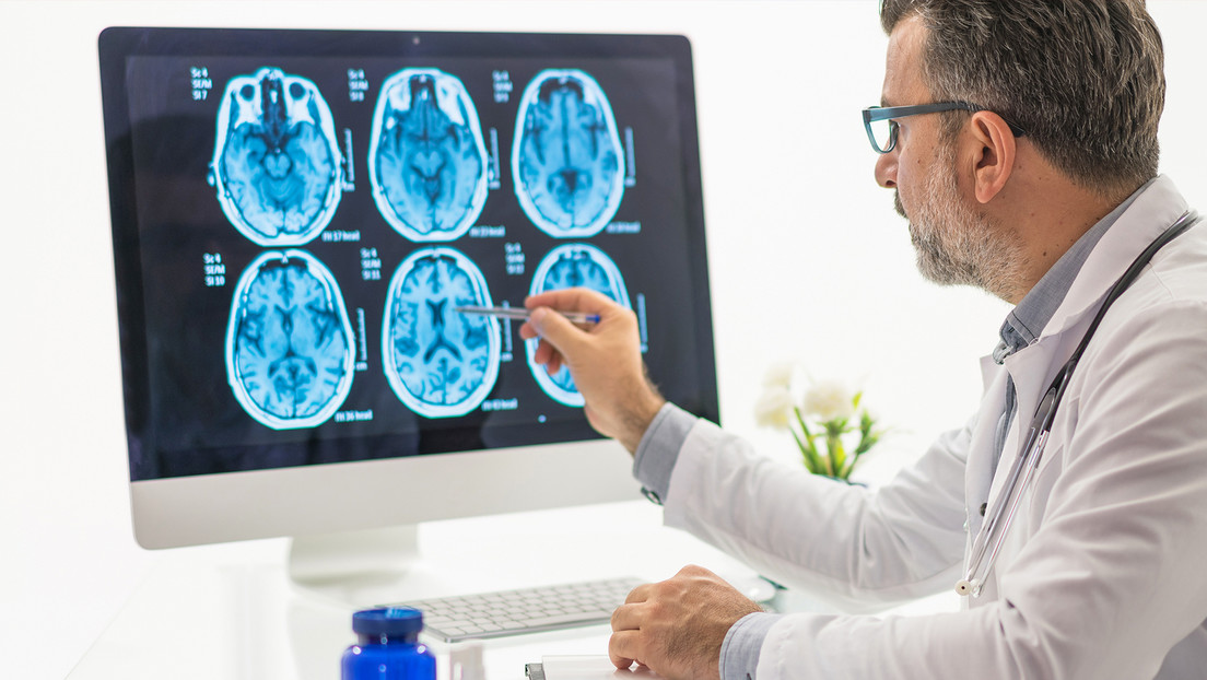 Identifican un factor que reduce el riesgo de demencia