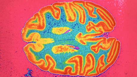 Desmienten uno de los mayores mitos sobre el cerebro