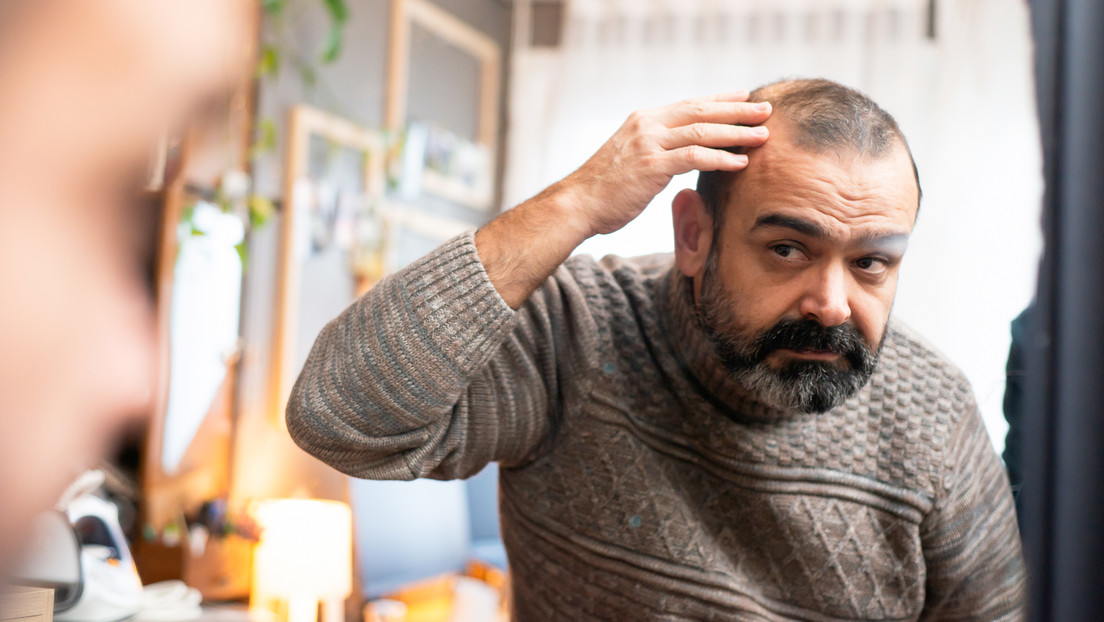 ¿Por qué el tratamiento contra la caída del cabello no funciona igual en todas las personas?