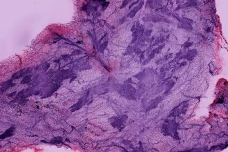 Este avance en microscopía deja ver lo que antes era imposible