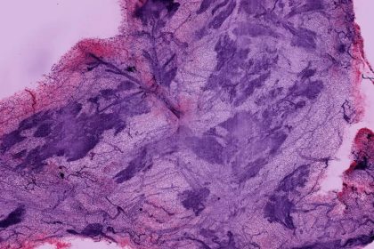 Este avance en microscopía deja ver lo que antes era imposible