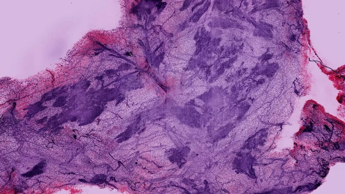 Este avance en microscopía deja ver lo que antes era imposible