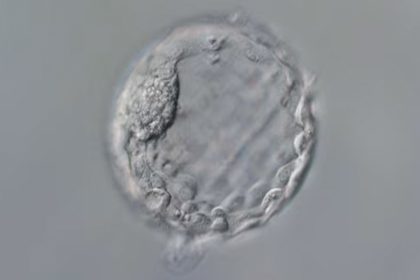 ¿Bebés a la сarta?: Científicos marcan nueva era en la modificación del ADN humano