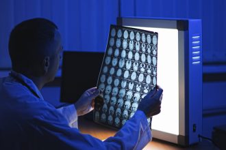 Médicos rusos realizan operación pionera de aneurisma cerebral