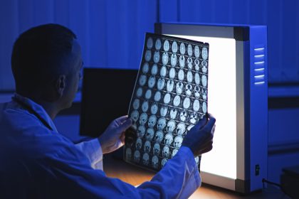 Médicos rusos realizan operación pionera de aneurisma cerebral